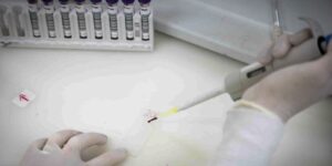 paciente-em-sp-com-suspeita-de-ebola-testa-positivo-para-meningite